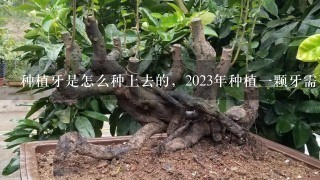 种植牙是怎么种上去的，2023年种植1颗牙需要多少钱？